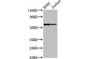 Western Blot Positive WB detected in: K562 whole cell lysate, Jurkat whole cell lysate All lanes: NAMPT antibody at 2.