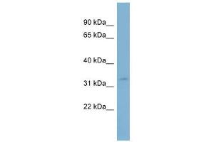 SLC25A20 antibody used at 1 ug/ml to detect target protein. (SLC25A20 Antikörper)