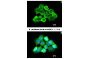 Immunofluorescence (IF) image for anti-ArfGAP with GTPase Domain, Ankyrin Repeat and PH Domain 3 (AGAP3) (C-Term) antibody (ABIN2856316)