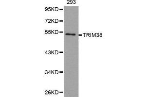 Western blot analysis of extracts of 293 cell line, using TRIM38 antibody. (TRIM38 Antikörper  (AA 266-465))