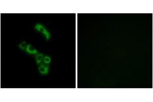 Immunofluorescence analysis of A549 cells, using C1QB Antibody. (C1QB Antikörper  (AA 161-210))