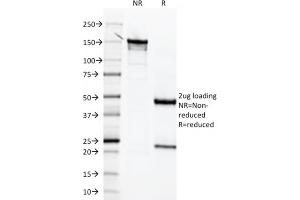 SDS-PAGE Analysis  Purified Mesothelin Mouse Monoclonal Antibody (MSLN/2131) (unconjugated).