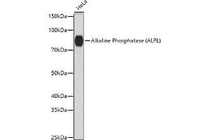 Western blot analysis of extracts of HeLa cells, using Alkaline Phosphatase (ALPL) antibody (ABIN6133557, ABIN6136824, ABIN6136825 and ABIN6216013) at 1:1000 dilution. (ALPL Antikörper  (AA 150-250))
