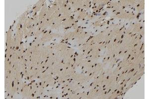 ABIN6273222 at 1/100 staining Mouse heart tissue by IHC-P.