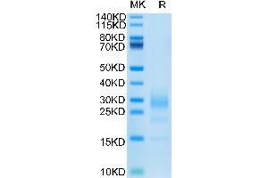 Mouse IL-5 Protein on Tris-Bis PAGE under reduced condition. (IL-5 Protein (AA 21-133) (His-Avi Tag))