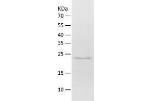 Western Blotting (WB) image for Pyruvate Dehydrogenase Kinase, Isozyme 4 (PDK4) (AA 138-368) protein (His tag) (ABIN7284577) (PDK4 Protein (AA 138-368) (His tag))