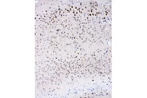 IHC analysis of IL-16 using anti-IL-16 antibody (ABIN5518927). (IL16 Antikörper  (AA 1205-1322))