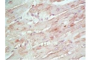 Immunohistochemistry (IHC) image for anti-Defensin, beta 108B (DEFB108B) antibody (ABIN2873091)