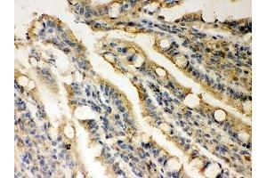 IHC-P: Rad51 antibody testing of rat intestine tissue (RAD51 Antikörper  (AA 1-258))