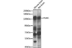 Western blot analysis of extracts of various cell lines, using PUM1 antibody (ABIN2737436) at 1:1000 dilution. (PUM1 Antikörper)