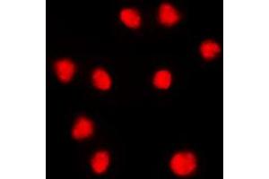 Immunofluorescent analysis of FOXC1/2 staining in THP1 cells.