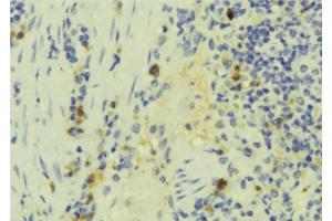 ABIN6272891 at 1/100 staining Human lymph tissue by IHC-P. (IFT57 Antikörper  (Internal Region))