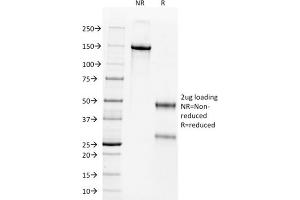 SDS-PAGE Analysis Purified Wilm's Tumor Mouse Monoclonal Antibody (WT1/857). (WT1 Antikörper)