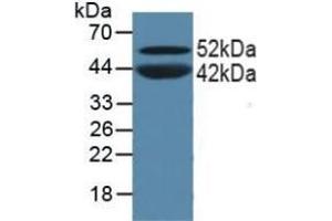 Detection of PPARa in Porcine Skeletal Muscle Tissue using Polyclonal Antibody to Peroxisome Proliferator Activated Receptor Alpha (PPARa) (PPARA Antikörper  (AA 61-170))