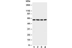 Western blot testing of RIP2 antibody and Lane 1:  A549;  2: HeLa;  3: PANC;  4: COLO320 cell lysate. (RIP2 Antikörper  (C-Term))