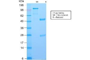 SDS-PAGE Analysis Purified BCL-6 Rabbit Recombinant Monoclonal Antibody (BCL6/2497R). (Rekombinanter BCL6 Antikörper  (AA 256-389))