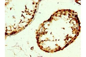 Immunohistochemistry (IHC) image for anti-RAB3 GTPase Activating Protein Subunit 2 (Non-Catalytic) (RAB3GAP2) (AA 277-387), (Catalytic Subunit) antibody (ABIN7166997)