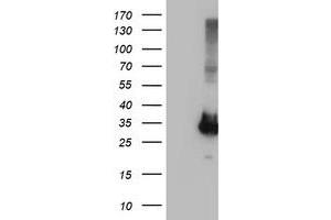 Image no. 1 for anti-Phenylethanolamine N-Methyltransferase (PNMT) antibody (ABIN1500316) (PNMT Antikörper)