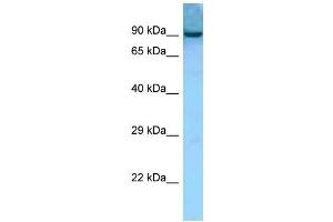 WB Suggested Anti-Aacs Antibody Titration: 1.