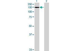 Western Blotting (WB) image for EP400 293T Cell Transient Overexpression Lysate(Denatured) (ABIN1337264)