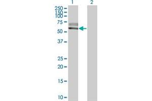 Western Blot analysis of ACVRL1 expression in transfected 293T cell line by ACVRL1 monoclonal antibody (M06), clone 2C12. (ACVRL1 Antikörper  (AA 22-119))