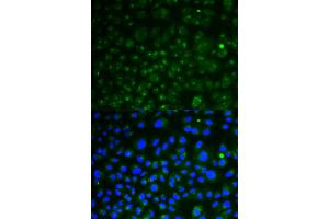 Immunofluorescence analysis of HeLa cells using LAMP1 antibody (ABIN5998110). (LAMP1 Antikörper)