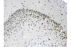 Immunohistochemistry (IHC) image for anti-Proteasome Subunit Alpha Type 3 (PSMA3) (AA 88-127), (Middle Region) antibody (ABIN4886706)