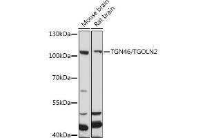 Western blot analysis of extracts of various cell lines, using TGN46/TGN46/TGOLN2 antibody (ABIN7270876) at 1:1000 dilution. (TGOLN2 Antikörper)