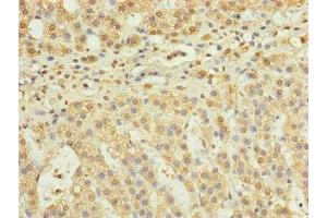 Immunohistochemistry of paraffin-embedded human adrenal gland tissue using ABIN7168124 at dilution of 1:100 (RPP25L Antikörper  (AA 1-163))