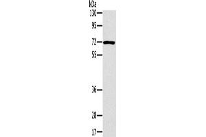 Western Blotting (WB) image for anti-Plastin 3 (PLS3) antibody (ABIN2423979) (Plastin 3 Antikörper)