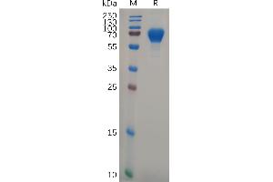 SDS-PAGE (SDS) image for Glycoprotein VI (Platelet) (GP6) (AA 21-267) protein (Fc Tag) (ABIN7092792)