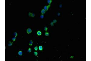 Immunofluorescent analysis of 293T cells using ABIN7165793 at dilution of 1:100 and Alexa Fluor 488-congugated AffiniPure Goat Anti-Rabbit IgG(H+L) (MANBAL Antikörper  (AA 45-85))
