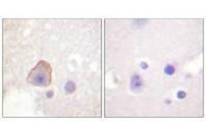 Immunohistochemical analysis of paraffin-embedded human brain tissue using ADD1 (Ab-726) antibody. (alpha Adducin Antikörper  (Ser726))