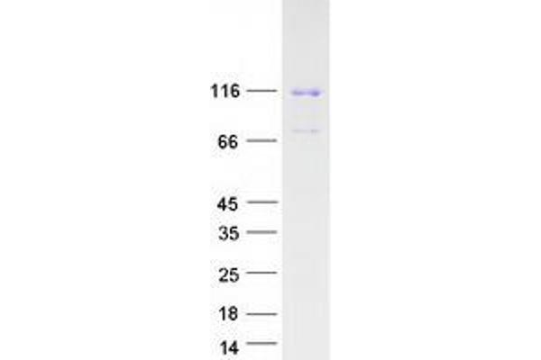 Axin Protein (Transcript Variant 2) (Myc-DYKDDDDK Tag)