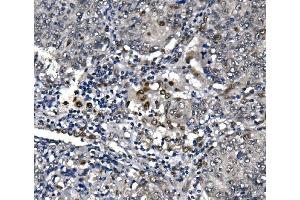 IHC analysis of POLR2A using anti-POLR2A antibody (ABIN7599598).