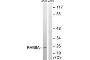 Western blot analysis of extracts from A549 cells, using RAB6A Antibody. (RAB6A Antikörper  (AA 113-162))