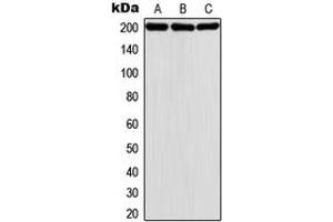Western blot analysis of MADD expression in HeLa (A), A431 (B), K562 (C) whole cell lysates.