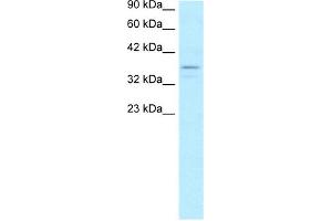 WB Suggested Anti-TAF7 Antibody Titration:  5.