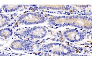Immunohistochemistry (IHC) image for anti-Interleukin 22 Receptor, alpha 1 (IL22RA1) (AA 267-565) antibody (ABIN7439531)