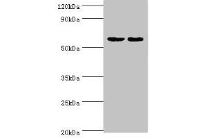 Western blot All lanes: Diacylglycerol kinase epsilon antibody at 5 μg/mL Lane 1: Rat brain tissue Lane 2: Hela whole cell lysate Secondary Goat polyclonal to rabbit IgG at 1/10000 dilution Predicted band size: 64, 21 kDa Observed band size: 64 kDa