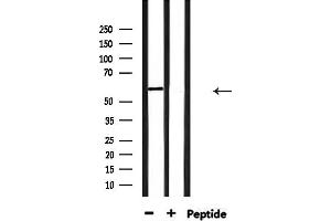 anti-YTH Domain Family, Member 1 (YTHDF1) (N-Term) antibody
