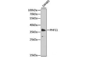 Western blot analysis of extracts of SW480 cells using PHF11 Polyclonal Antibody at dilution of 1:1000. (PHF11 Antikörper)