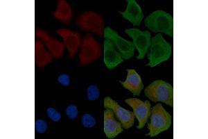 ABIN6258241 and ABIN6274503 staining Hela cells by IF/ICC. (ILKAP Antikörper  (N-Term))