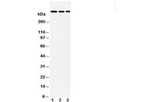 Western blot testing of LAMA2 antibody and Lane 1:  HeLa (Laminin Antikörper  (AA 152-170))