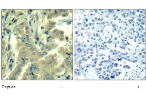 Image no. 1 for anti-Phospholipase C gamma 2 (PLCG2) (Tyr1217) antibody (ABIN319401) (Phospholipase C gamma 2 Antikörper  (Tyr1217))