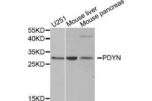 Western blot analysis of extracts of various cell lines, using PDYN antibody. (PDYN Antikörper)