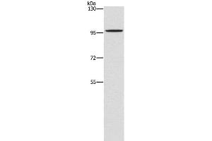 Western Blot analysis of A172 cell using PDE6C Polyclonal Antibody at dilution of 1:1400 (PDE6C Antikörper)