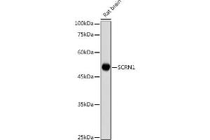 Western blot analysis of extracts of Rat brain , using SCRN1 antibody (ABIN7270175) at 1:1000 dilution. (Secernin 1 Antikörper)