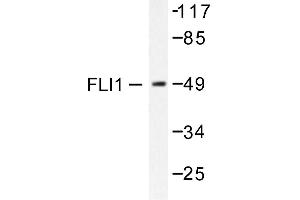Image no. 1 for anti-Friend Leukemia Virus Integration 1 (FLI1) antibody (ABIN265422) (FLI1 Antikörper)