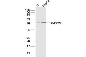 ZNF763 Antikörper  (AA 301-394)